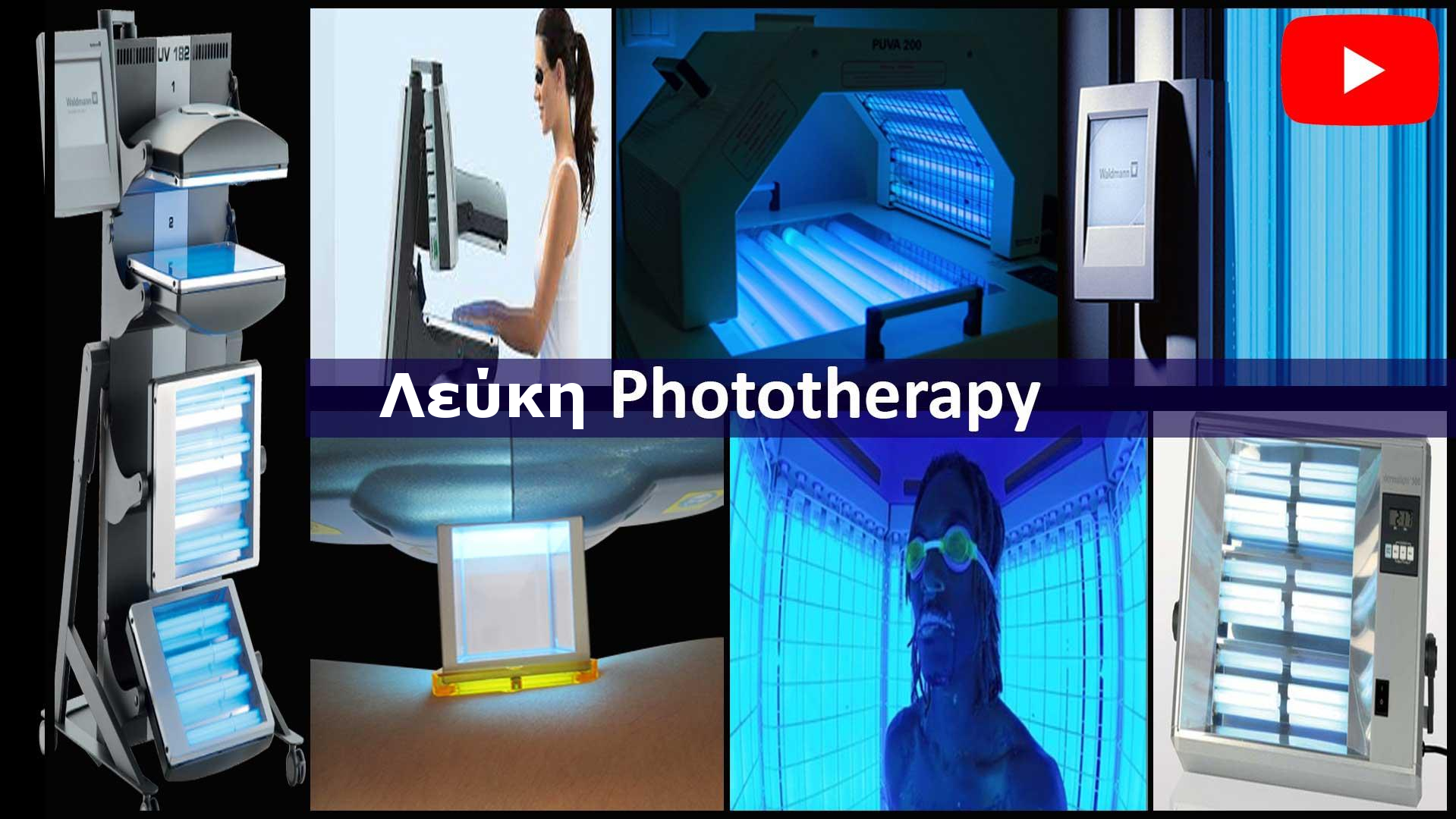 Free Phototherapy for Vitiligo in Vitiligo Center Vitiligo Center